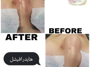عرسك قرب؟؟👰🤵💑
🌸بشرتك باهته ومافيها نضاره!