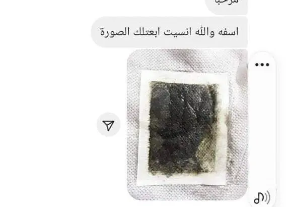 عرض لاصقات بديل الحجامه