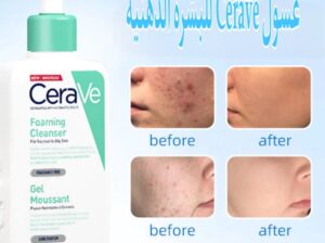 غسول Cerave للبشرة الدهنية